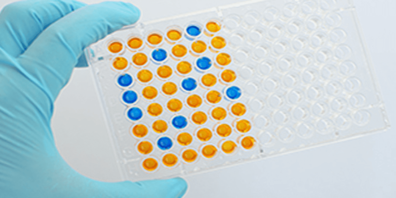 Immunologie - Test ELISA