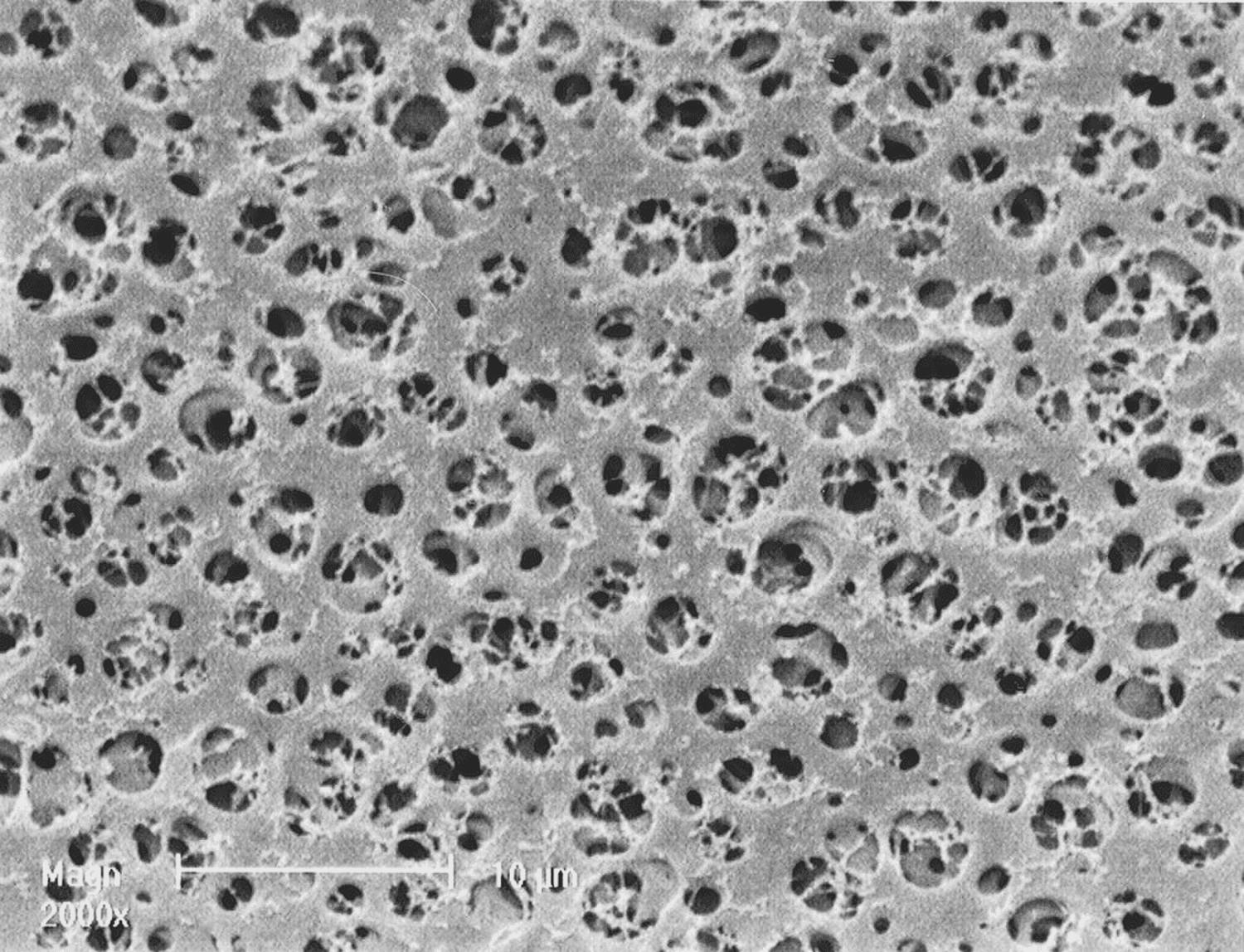 Filtre membrane en acétate de cellulose type 111 stérile