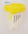 Flacon 60ml en polypropylène pour ECBU avec prise pour tube sous vide stérile avec étiquette
