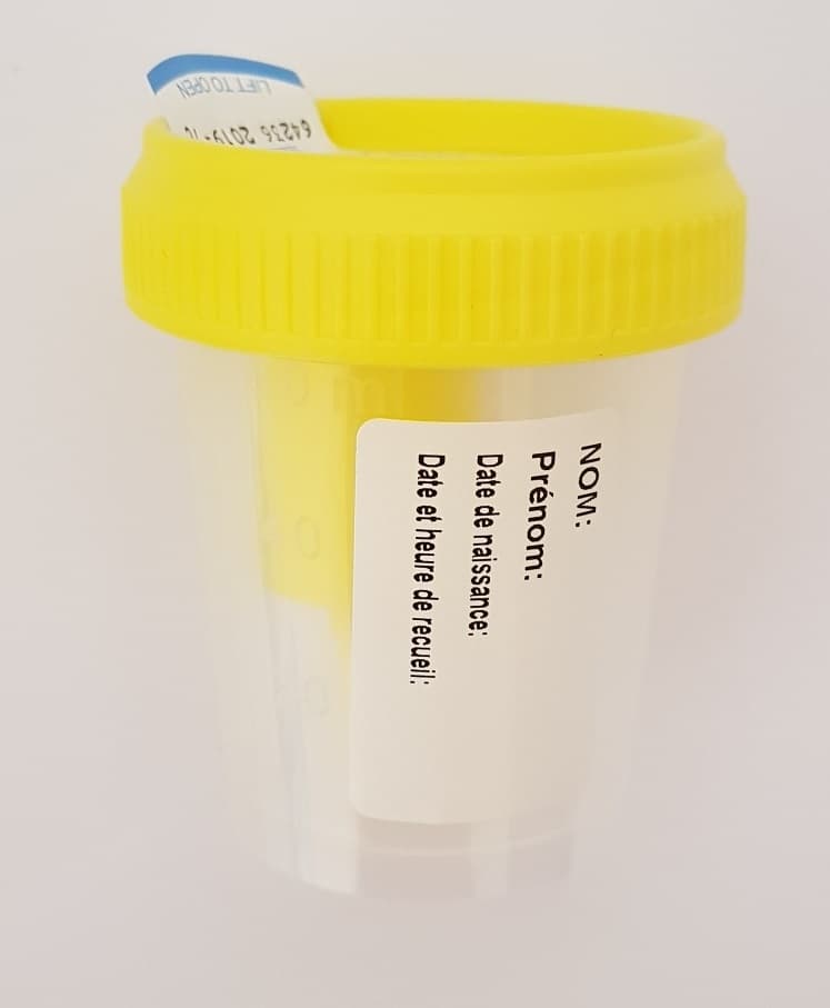 Flacon 60ml en polypropylène pour ECBU avec prise pour tube sous vide stérile avec étiquette