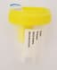 Flacon 60ml en polypropylène pour ECBU avec prise pour tube sous vide stérile avec étiquette