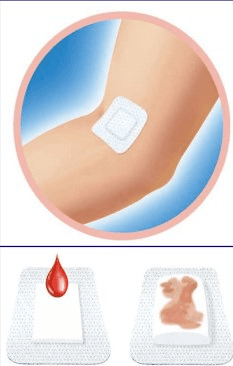 Pansement compressif EmoSoffix 3,8x3,8cm