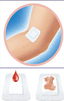 Pansement compressif EmoSoffix 3,8x3,8cm