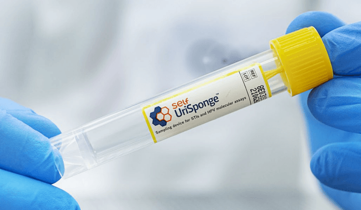 Self UriSponge™ tube et éponge avec conservateur pour recueil et transport d'urine stérile, tube 16x100m, pour auto-prélèvement