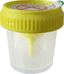 Flacon 30ml en polypropylène pour ECBU avec prise pour tube sous vide stérile